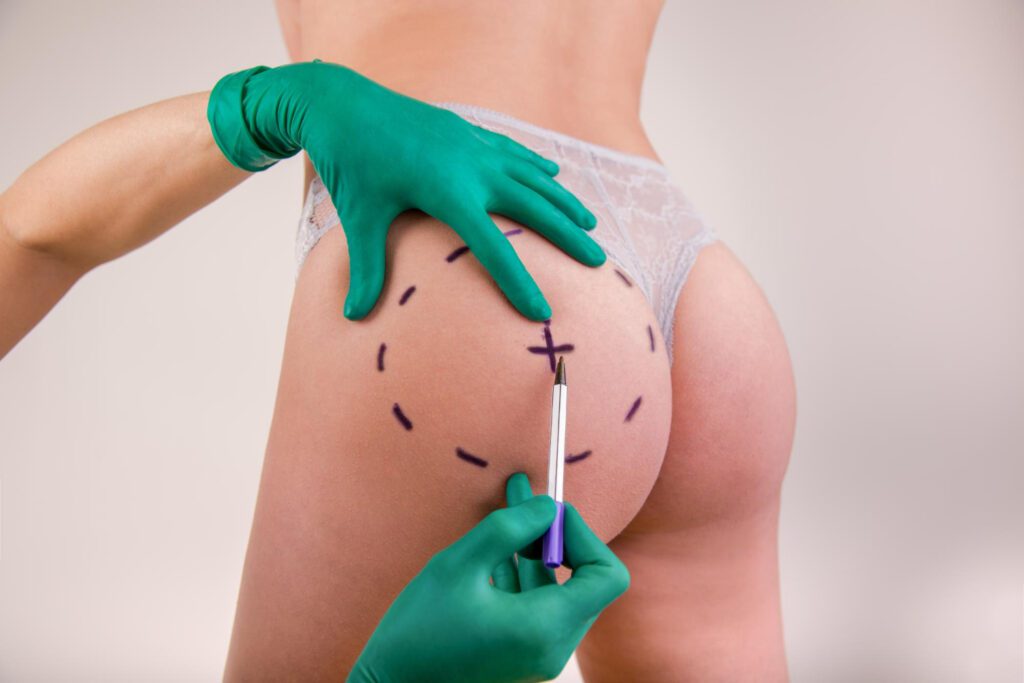 How to Choose a Plastic Surgeon*