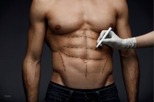 Young Man's Fit Torso With Surgical Lines On His Body