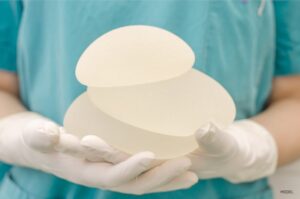 breast augmentation surgery in miami