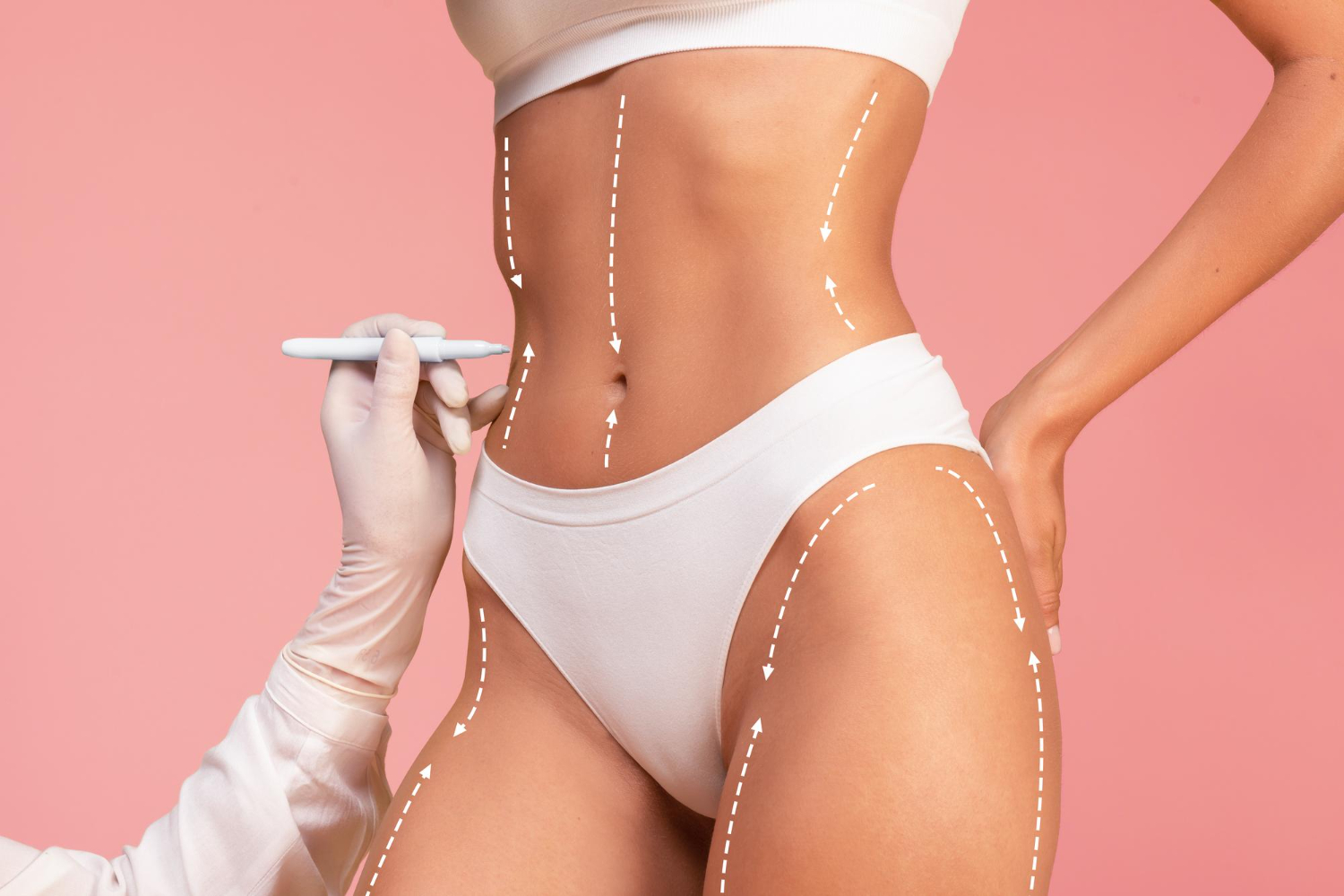 Liposuction Services in Miami